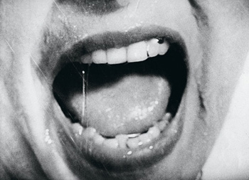 Клиника маниакально-депрессивного психоза