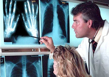 Полиартрит