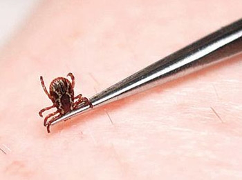 Клещевые инфекции