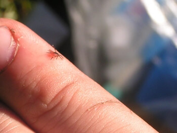 Страшный диагноз – энцефалит