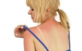 Как не обгореть на солнце