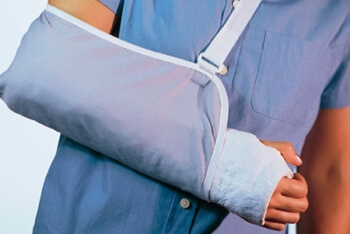 Перелом кости