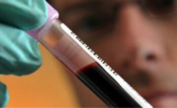 Профилактика онкозаболеваемости