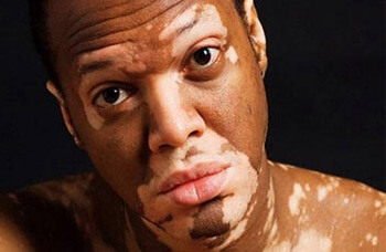 Редкие заболевания