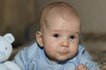 Важные вопросы о рахите